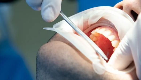 Image20260313-tonguecancer